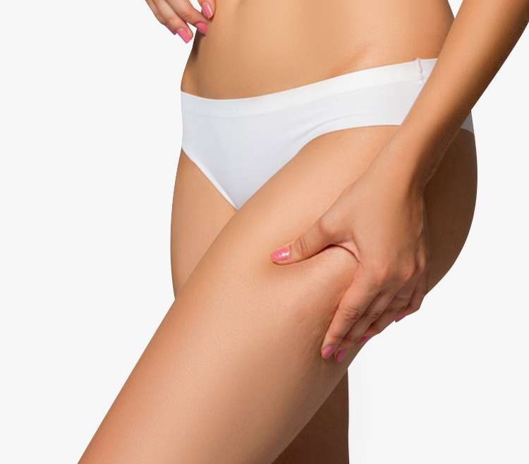 Liposuccion cuisse en Tunisie : la lipoaspiration pour de belles cuisses