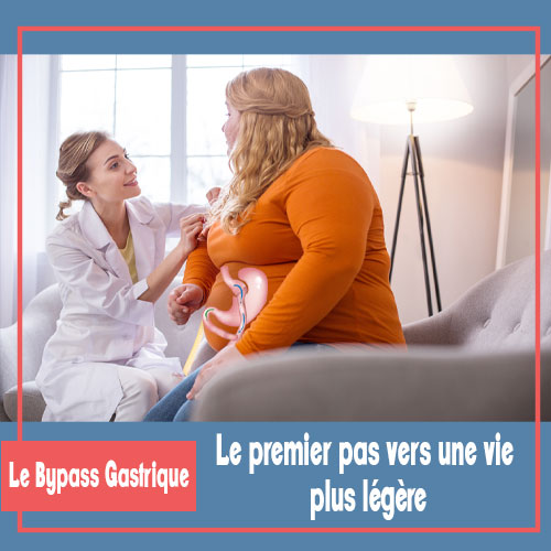 BYPASS GASTRIQUE tunisie prix 